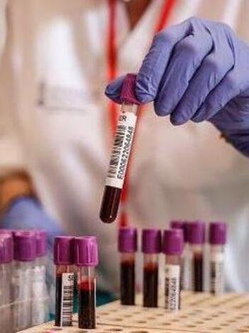 Ampolas contendo sangue