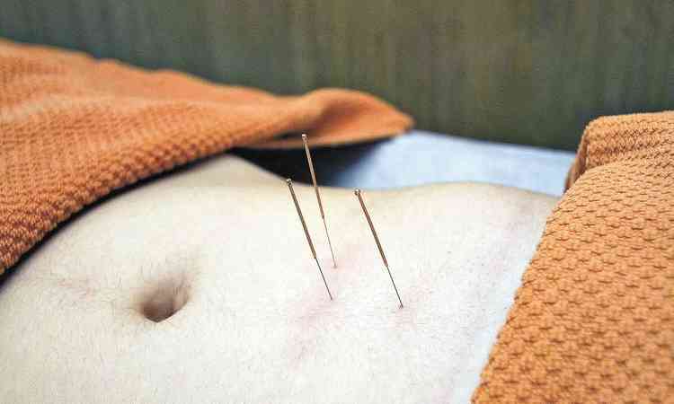 Agulhas de acupuntura na barriga