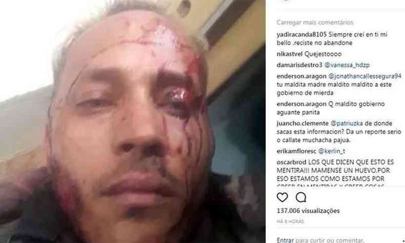 Ex-policial divulgou vdeo com o rosto ensanguentado(foto: Reproduo/Instagram)