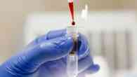 Biópsia líquida: exame de sangue permite acompanhar evolução do câncer