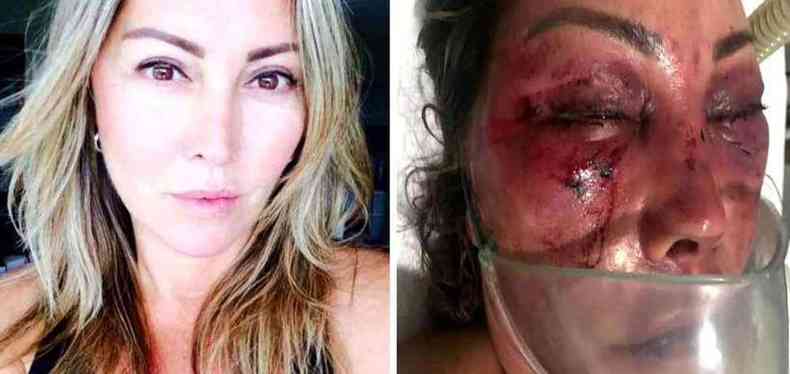 A empresria Elaine Perez Caparroz, antes e depois das agresses(foto: Reproduo/TV Globo)