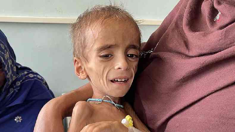 Criança em hospital de Kandahar, em 14 de outubro de 2021