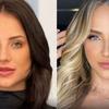 Gabi Martins comemora reversão de harmonização facial
