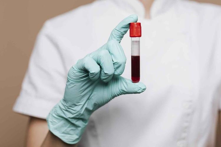 Enfermeira segurando tubo de sangue