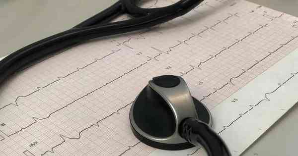 Eletrocardiograma: exame pode diagnosticar diabetes - Estado de Minas