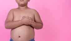 Obesidade mrbida infantil: obesos tm mais filhos com problema de peso