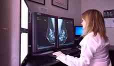 Tudo o que você precisa saber sobre mamografia, chave no diagnóstico de câncer de mama