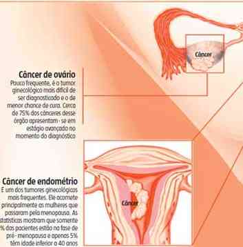 Em pases onde o exame  realizado com ampla cobertura populacional, os casos desse tipo de tumor em estgio avanado chegaram a cair em mais de 70%