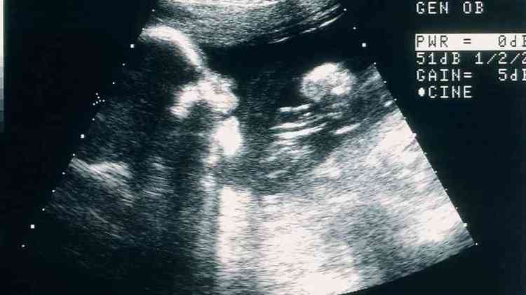uma ultrassonografia
