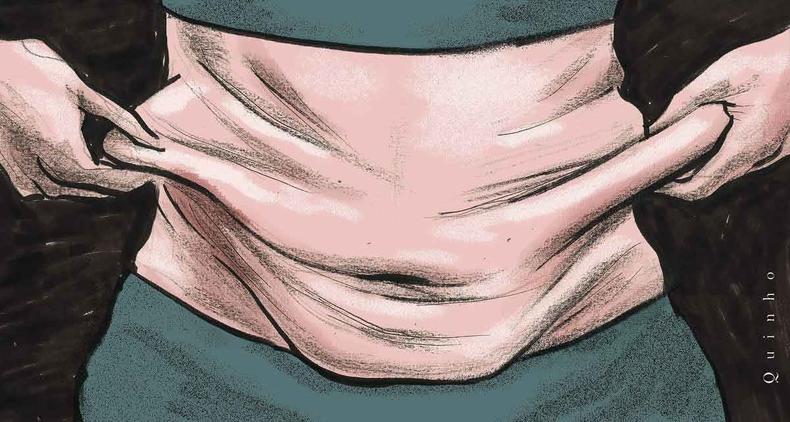 Ilustrao sobre flacidez da pele