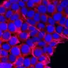 Câncer de pâncreas: pesquisa com vacina de mRNA para combater o tumor
