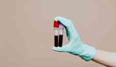 Exames identificam fatores de coagulao sangunea para tratar hemofilia