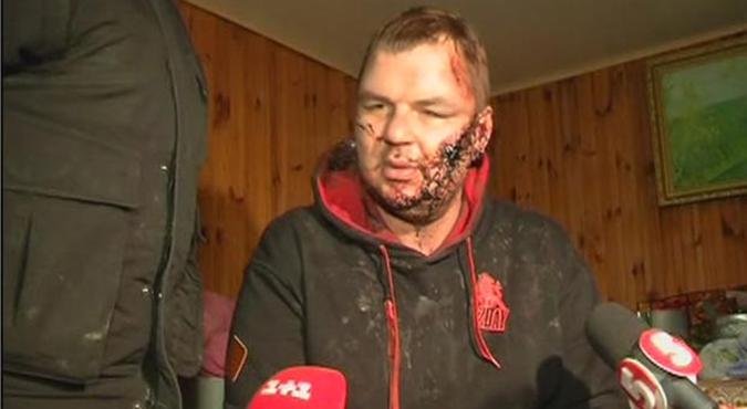 O motorista Dmytro Bulatov ficou uma semana em cativeiro sendo torturado e teve a orelha decepada. Agora � o novo ministro de Esportes e da Juventude de seu pa�s(foto: Reuters)