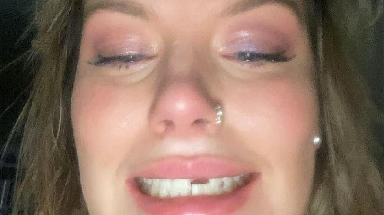 Selfie de reegan sem um dente da frente