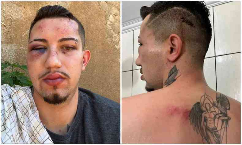 Duas fotos do jovem Marcos, uma de frente e outra de costas, mostram hematomas no rosto, no olho e parte de trs da cabea 