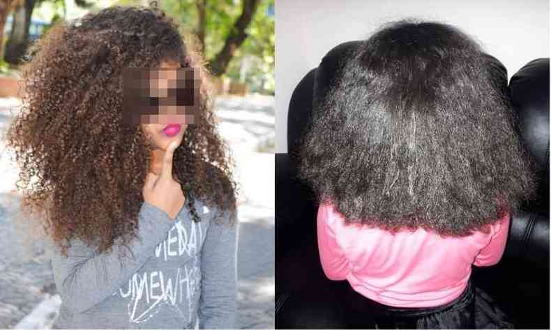 (foto: Me publicou fotos no Facebook do cabelo da criana antes e depois da interveno)