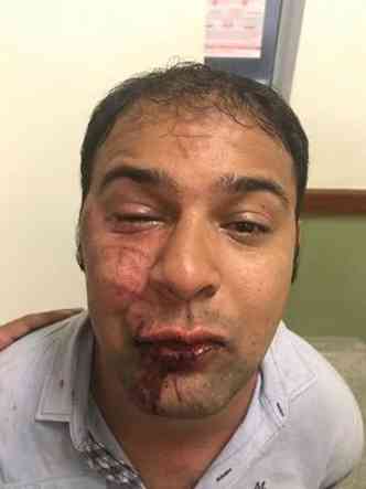 Vereador apresentava sinais de ter bebido antes de dirigir e terminou com vrios cortes do rosto. PM alega que ele agrediu militares e caiu no cho, machucando a face(foto: Maycon Willian/Divulgao)