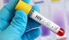 HIV: mesmo com antirretroviral, vírus não fica totalmente adormecido