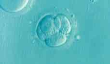 Fotos mostram que no h embrio visvel at 9 semanas de gravidez