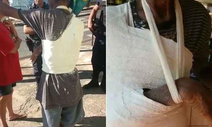Vídeos mostram homem com tronco e braço coberto de gesso por cima da camisa(foto: Reprodução da internet) Vídeos mostram homem com tronco e braço coberto de gesso por cima da camisa(foto: Reprodução da internet)