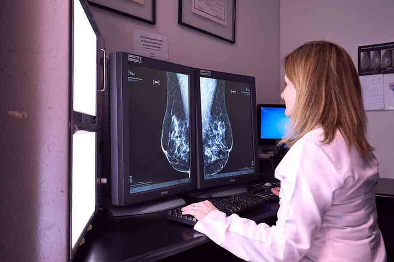 mamografias