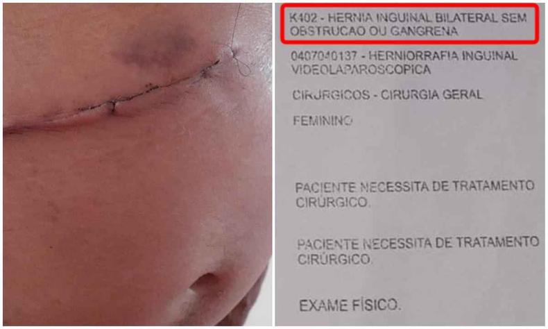Em vez da retirada da hérnia (como mostra encaminhamento na foto), Assis Fernandes foi submetido a uma cirurgia de vesícula(foto: Assis Fernandes/Arquivo pessoal) Barriga com cicatriz de cirurgia errada e documento do agendamento