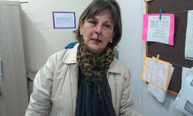 Foto postada por Marcia Friggi, após ser agredida: Foto postada por Marcia Friggi, após ser agredida:
