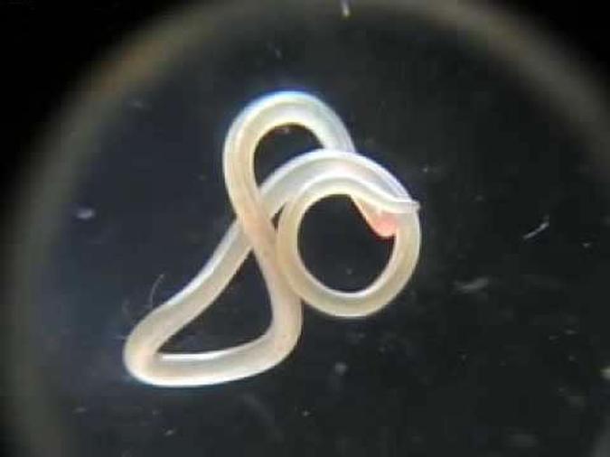 Imagem do Ascaris lumbricoides(foto: Internet) Imagem do Ascaris lumbricoides(foto: Internet)