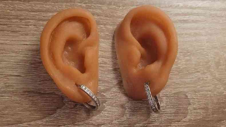 As orelhas artificiais de Janet Craven