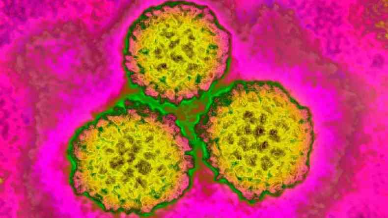 No caso do HPV, a vacina gera uma resposta imunolgica mais forte do que o prprio vrus.(foto: Getty Images)