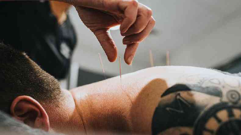 Paciente fazendo acupuntura