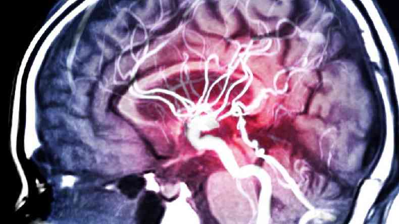 Imagem de ressonncia magntica do crebro humano