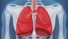 Embolia pulmonar: sintomas leves podem ser confundidos com outras doenas
