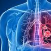 Especialista alerta para riscos da tuberculose pulmonar não tratada