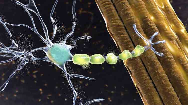 A esclerose lateral amiotrfica afeta as clulas nervosas que controlam os movimentos voluntrios dos msculos %u2013 os chamados neurnios motores