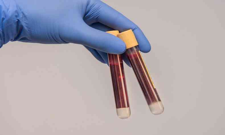 Amostras de sangue e medula de pacientes que tiveram COVID-19 leve foram coletadas para o estudo (foto: Pixabay/Reproduo )