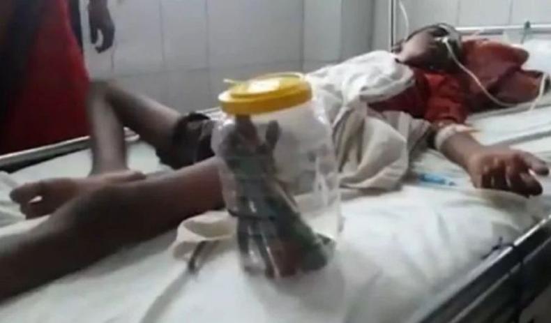 Jovem passa por cirurgia na india 