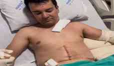 Regis Danese mostra resultado da cirurgia na barriga, veja vdeo