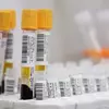 Doença de Parkinson poderá ser diagnosticada por exame de sangue simples