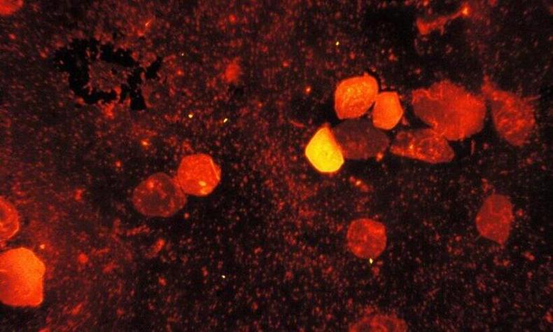 bactria da tuberculose
