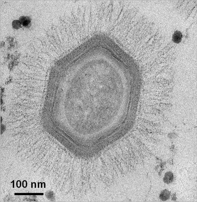 Imagem microscpica do mimivrus(foto: Divulgao)