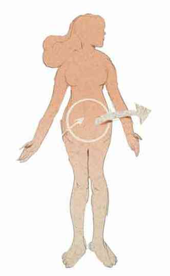 Ilustrao sobre endometriose mostra mulher e setas apontando para o tero dela