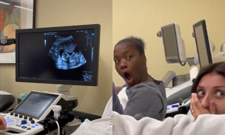 A garota conta que todos sabiam que a aluna estava grávida (foto: Reprodução Redes Sociais ) Montagem de fotos de um ultrassom com as amigas em espanto