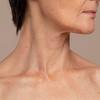 Deep Neck Lift: a técnica que rejuvenesce até os músculos do pescoço