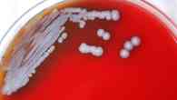 Perigosa bactéria achada no Mississipi (EUA) deixa autoridades em alerta