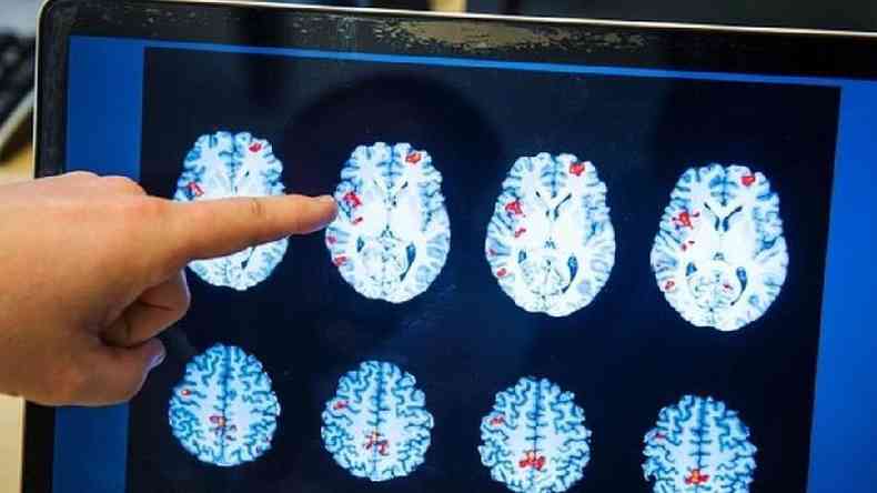 Ao longo da vida, nosso crebro se transforma de maneira constante(foto: Getty Images)
