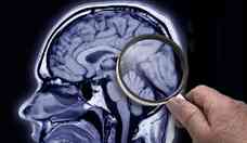 Cientistas descobrem uma nova estrutura no crebro humano