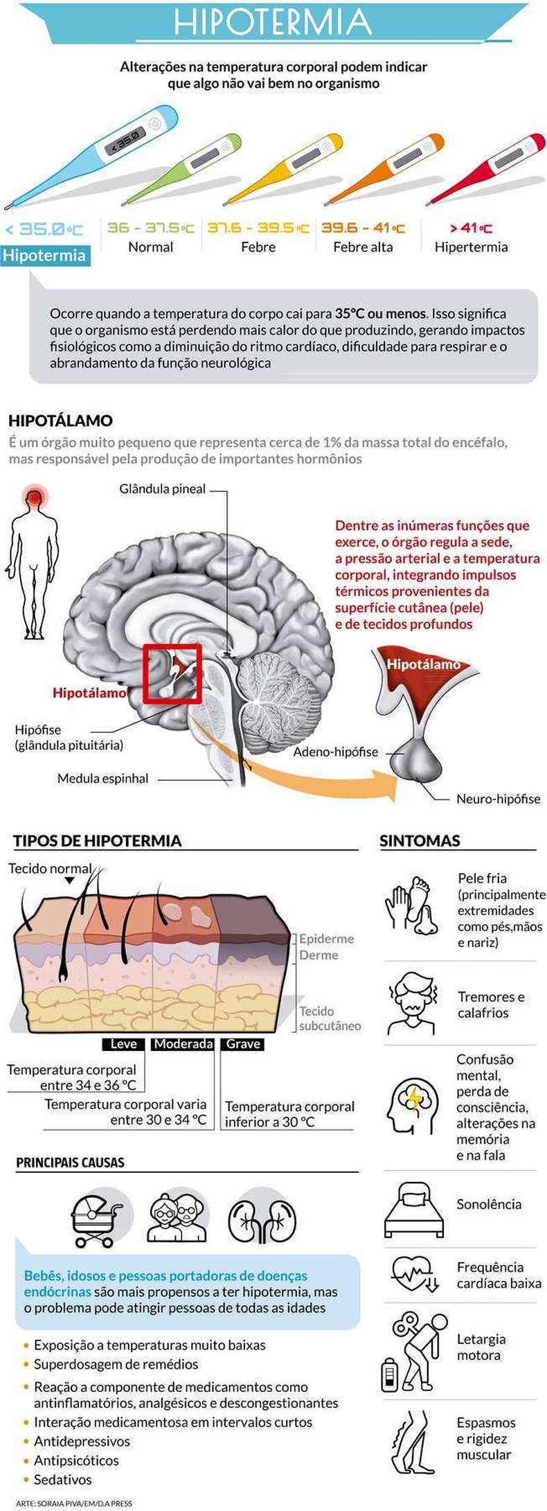 Infogrfico explicando o que  hipotermia