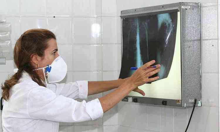 Mdica mostrando radiografia de paciente