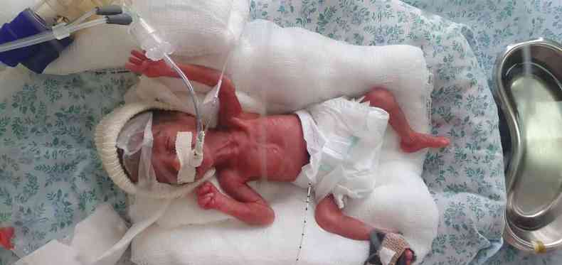 Luca  um caso de beb prematuro extremo(foto: Famlia )